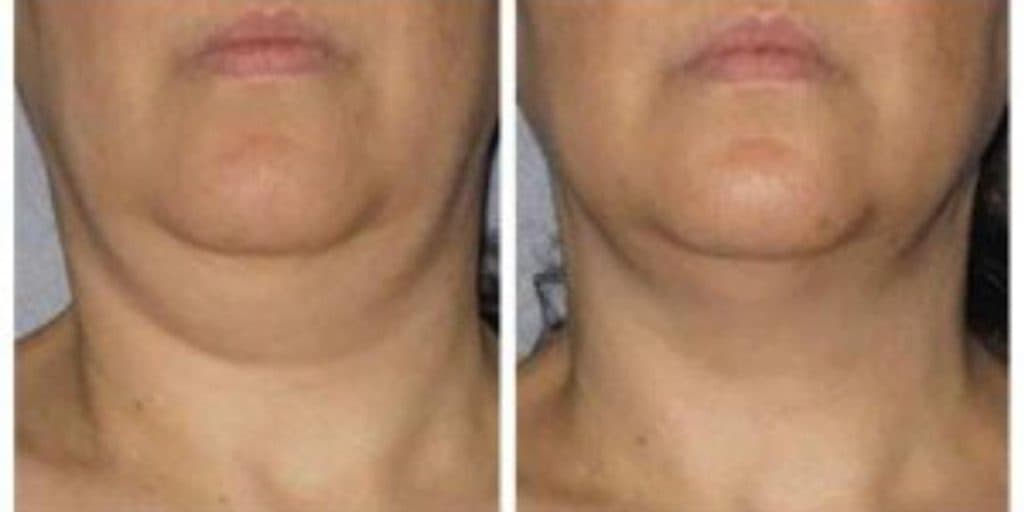 خدمات تخصصی پوست و مو منیره بیوتی در پونک جنوبی تهران