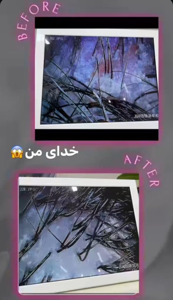 مرکز تخصصی اسکالپ و پاکسازی پوست سر زیبا عسکری در رفسنجان