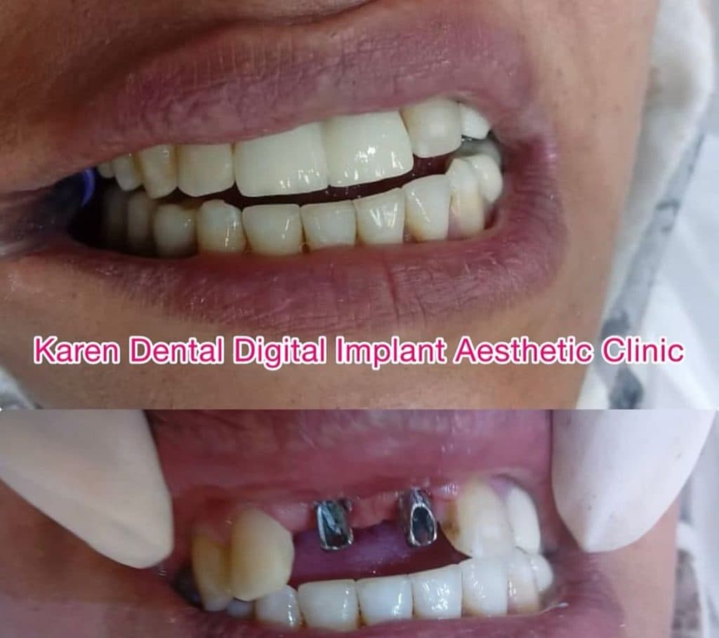 کلینیک دندانپزشکی و ایمپلنت دیجیتال کارن در کرمان