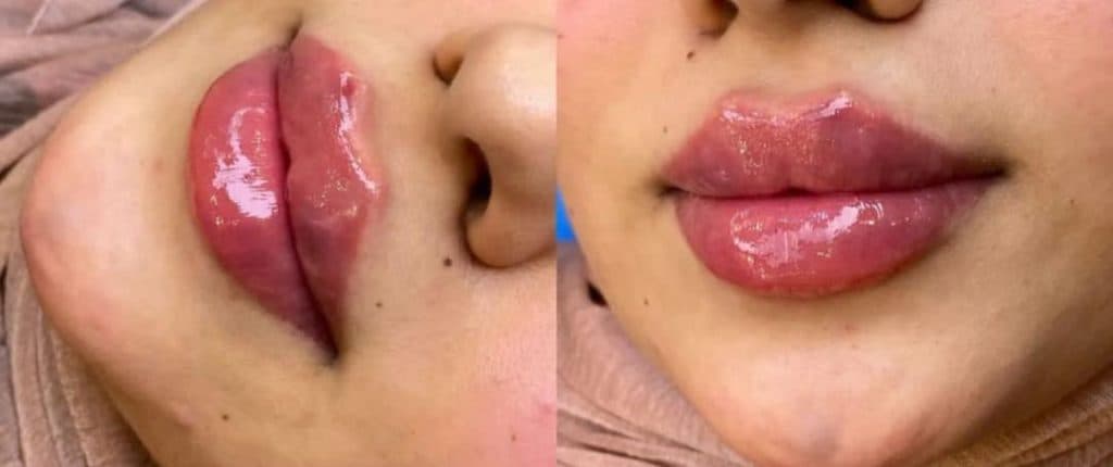 کلینیک زیبایی آس در چهارراه عمار یاسر ارومیه