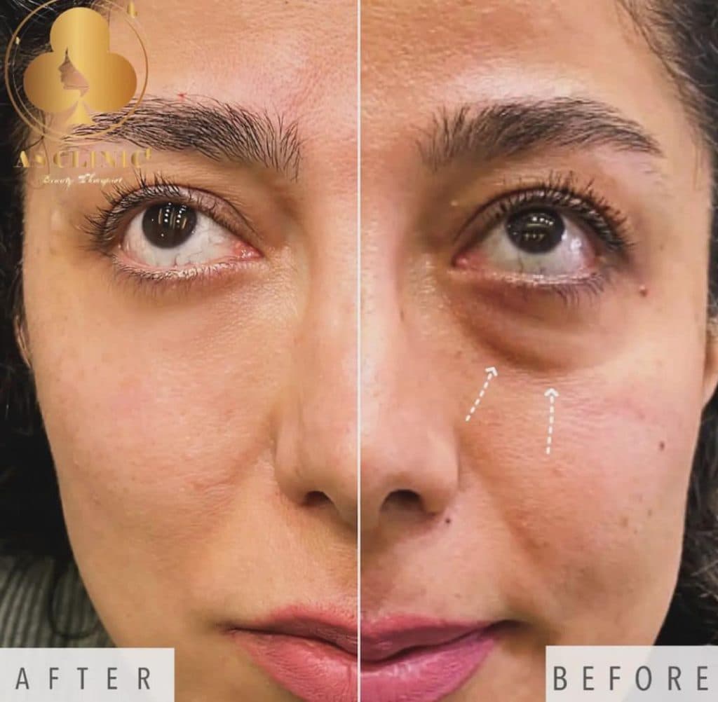 کلینیک زیبایی آس در چهارراه عمار یاسر ارومیه