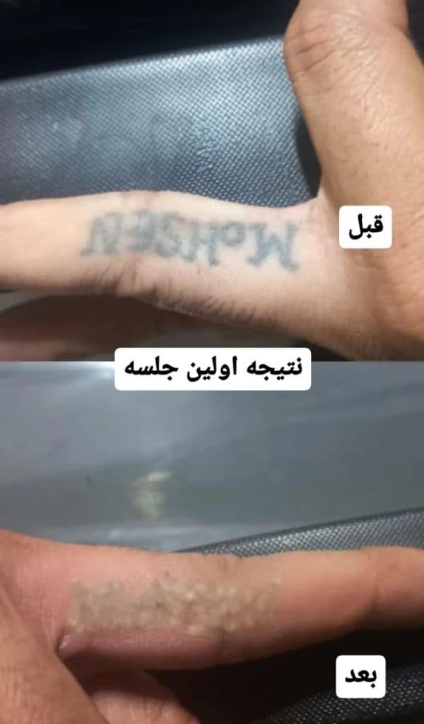 کلینیک لیزر کاکتوس در ساوه