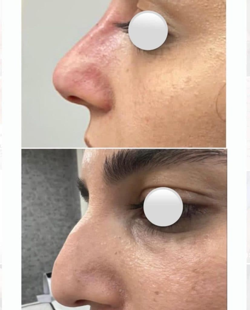 کلینیک زیبایی لیزر vip آفتاب در ولیعصر تبریز