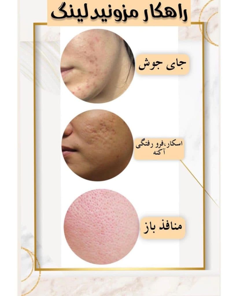 کلینیک زیبایی لیزر vip آفتاب در ولیعصر تبریز