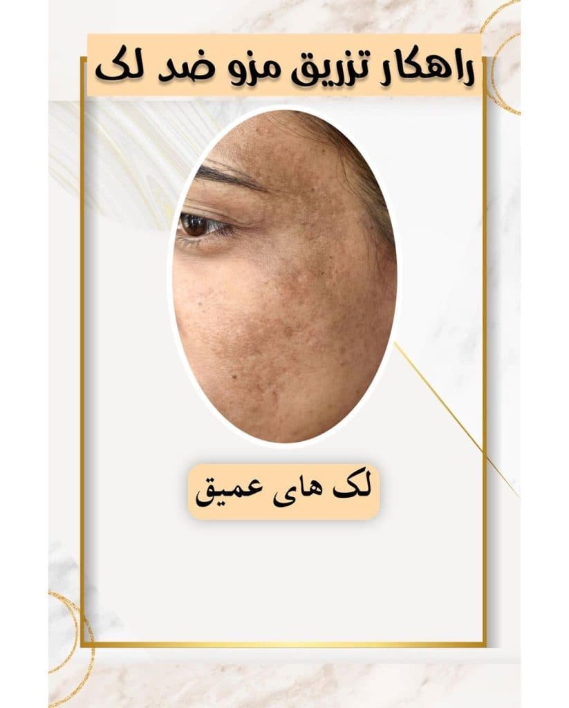 کلینیک زیبایی لیزر vip آفتاب در ولیعصر تبریز