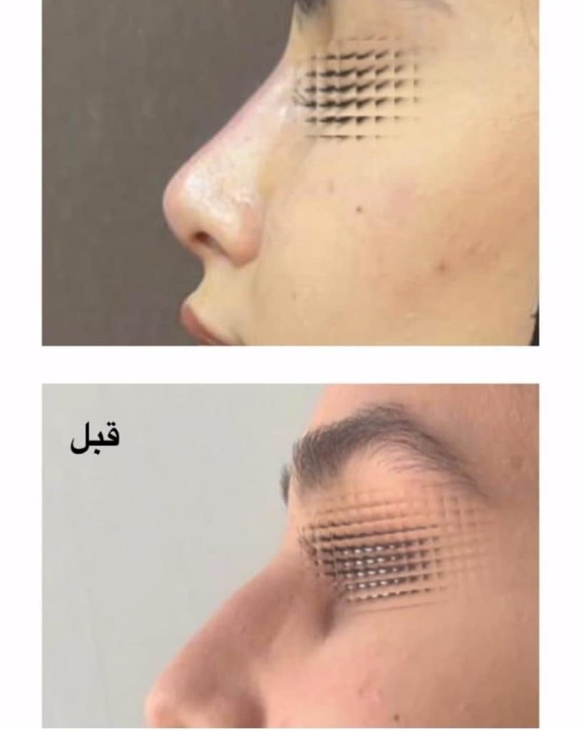 کلینیک زیبایی لیزر vip آفتاب در ولیعصر تبریز