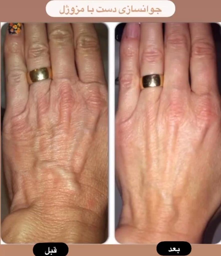 کلینیک زیبایی لیزر vip آفتاب در ولیعصر تبریز