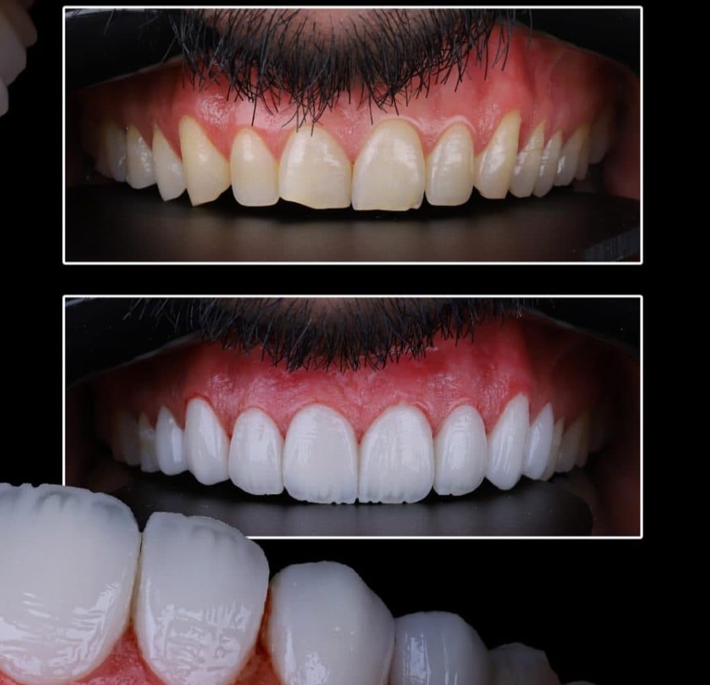 مطب دندانپزشکی دکتر عبدالهی در اباذر خوراسگان