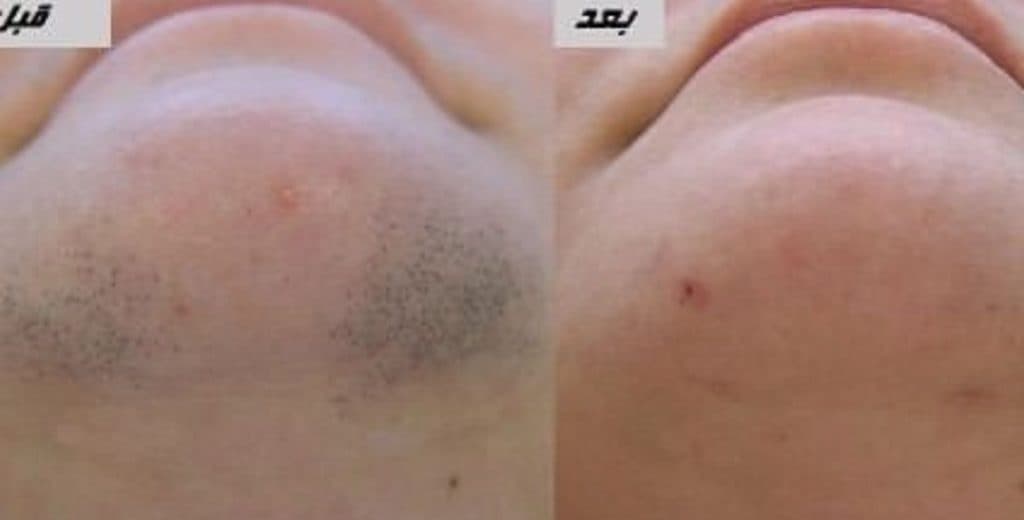 کلینیک زیبایی آویژه در چهارراه طالقانی کرج