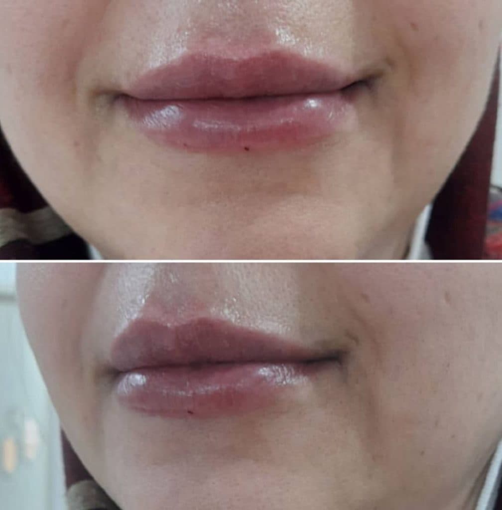 کلینیک زیبایی آویژه در چهارراه طالقانی کرج