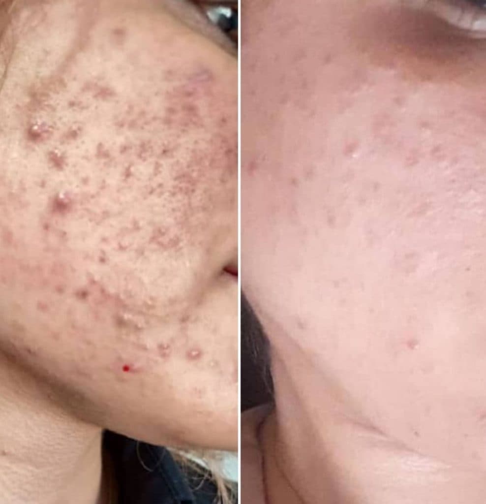 کلینیک زیبایی آویژه در چهارراه طالقانی کرج