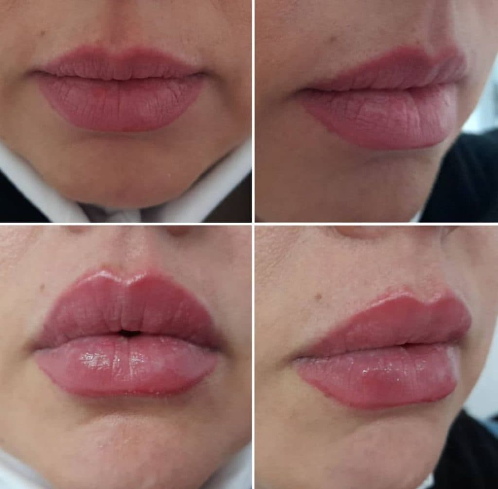 کلینیک زیبایی آویژه در چهارراه طالقانی کرج