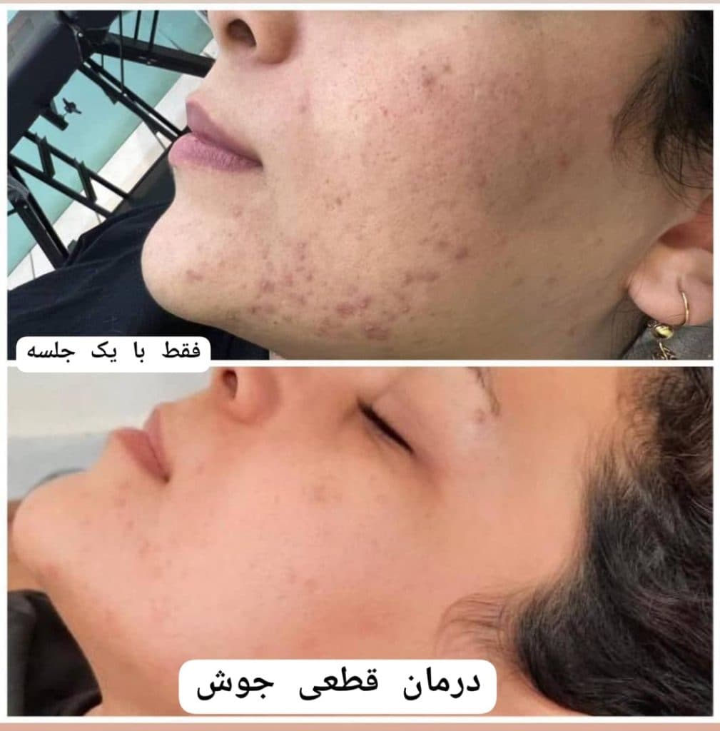 آموزش و خدمات تخصصی پاکسازی پوست سارا مزروعی در اصفهان