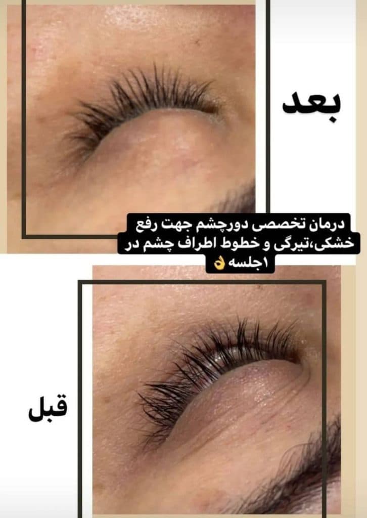 آموزش و خدمات تخصصی پاکسازی پوست سارا مزروعی در اصفهان