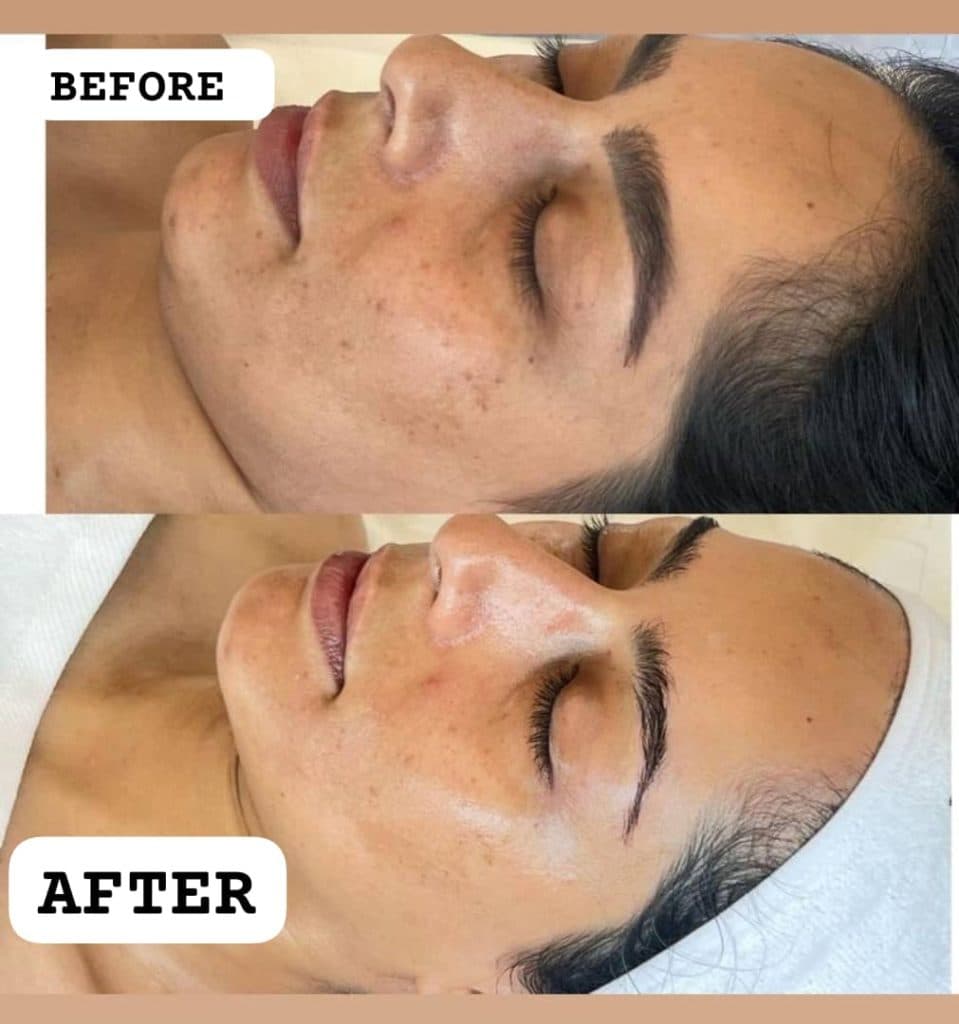 آموزش و خدمات تخصصی پاکسازی پوست سارا مزروعی در اصفهان