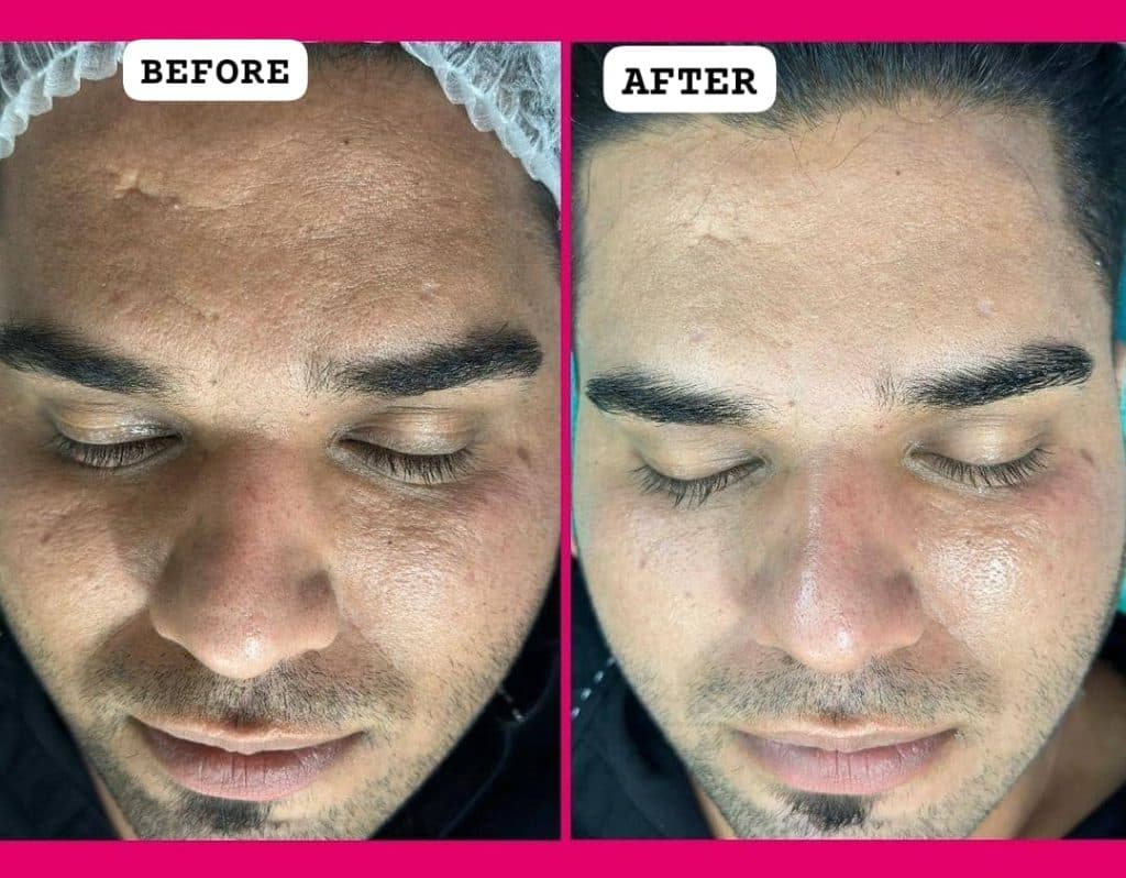 آموزش و خدمات تخصصی پاکسازی پوست سارا مزروعی در اصفهان