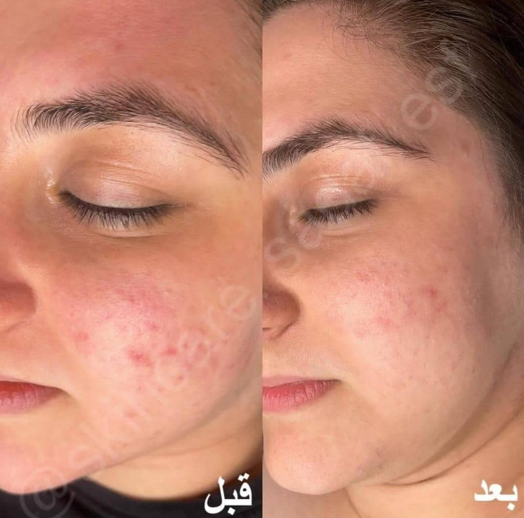 آموزش و خدمات تخصصی پاکسازی پوست صدف زنگنه در اصفهان