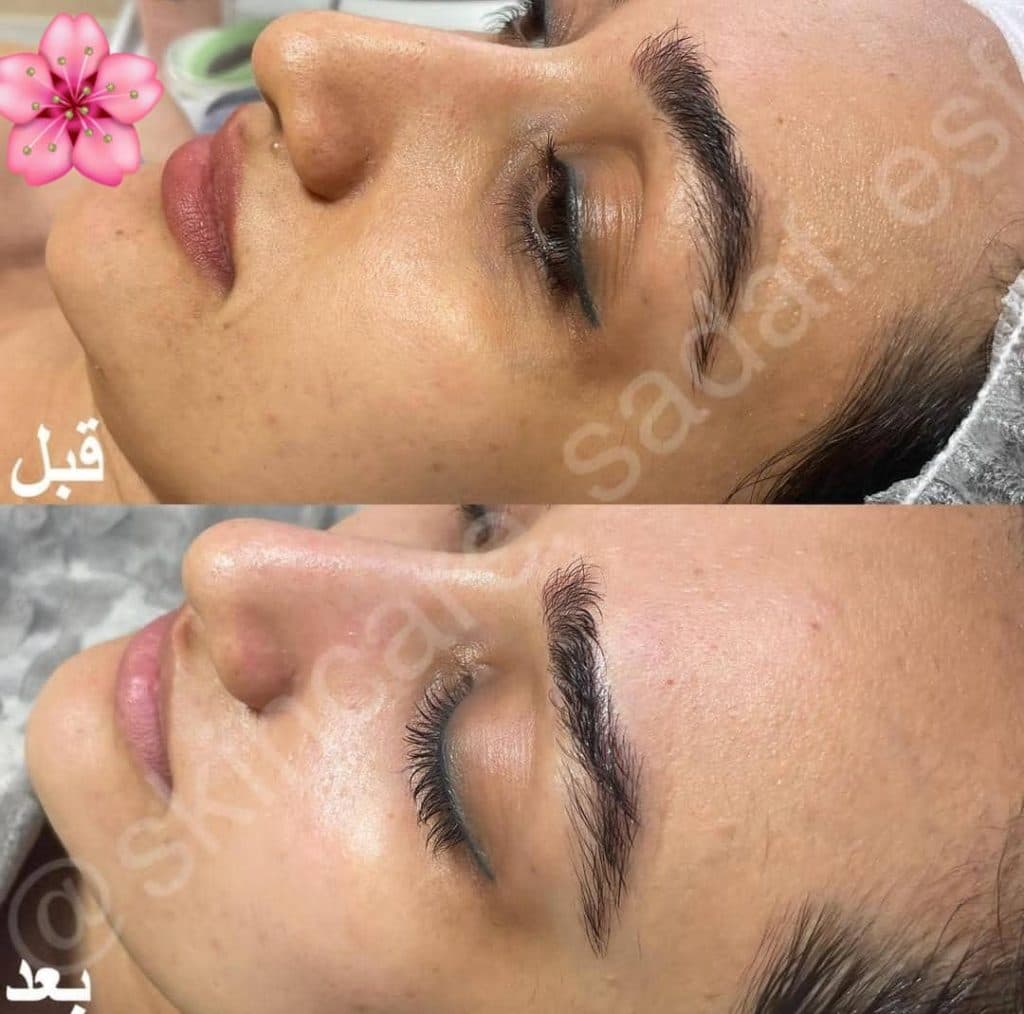 آموزش و خدمات تخصصی پاکسازی پوست صدف زنگنه در اصفهان