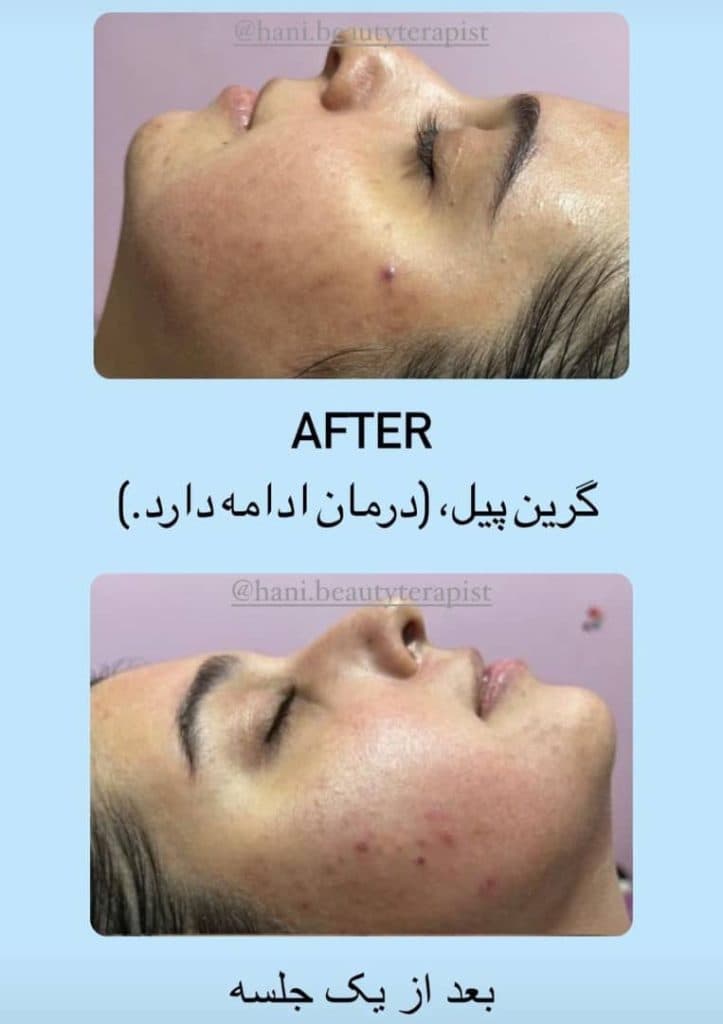 آکادمی تخصصی مراقبت از پوست و مو حانیه چاوشی در قم