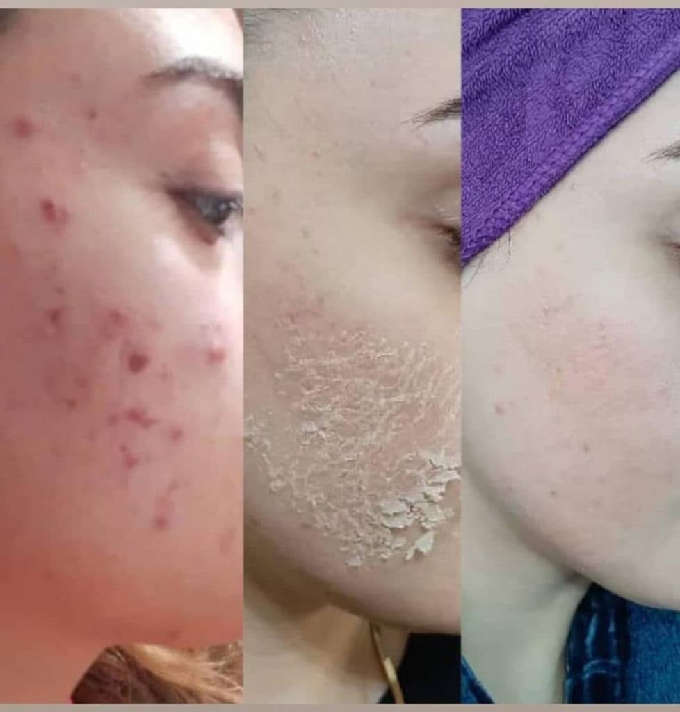 آکادمی تخصصی مراقبت از پوست و مو حانیه چاوشی در قم