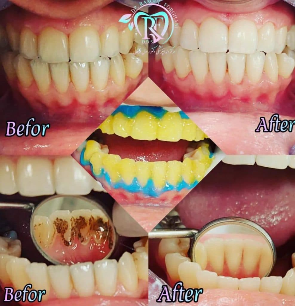مرکز دندانپزشکی دکتر رسول فرقانی در بلوار طالقانی جنوبی کرج