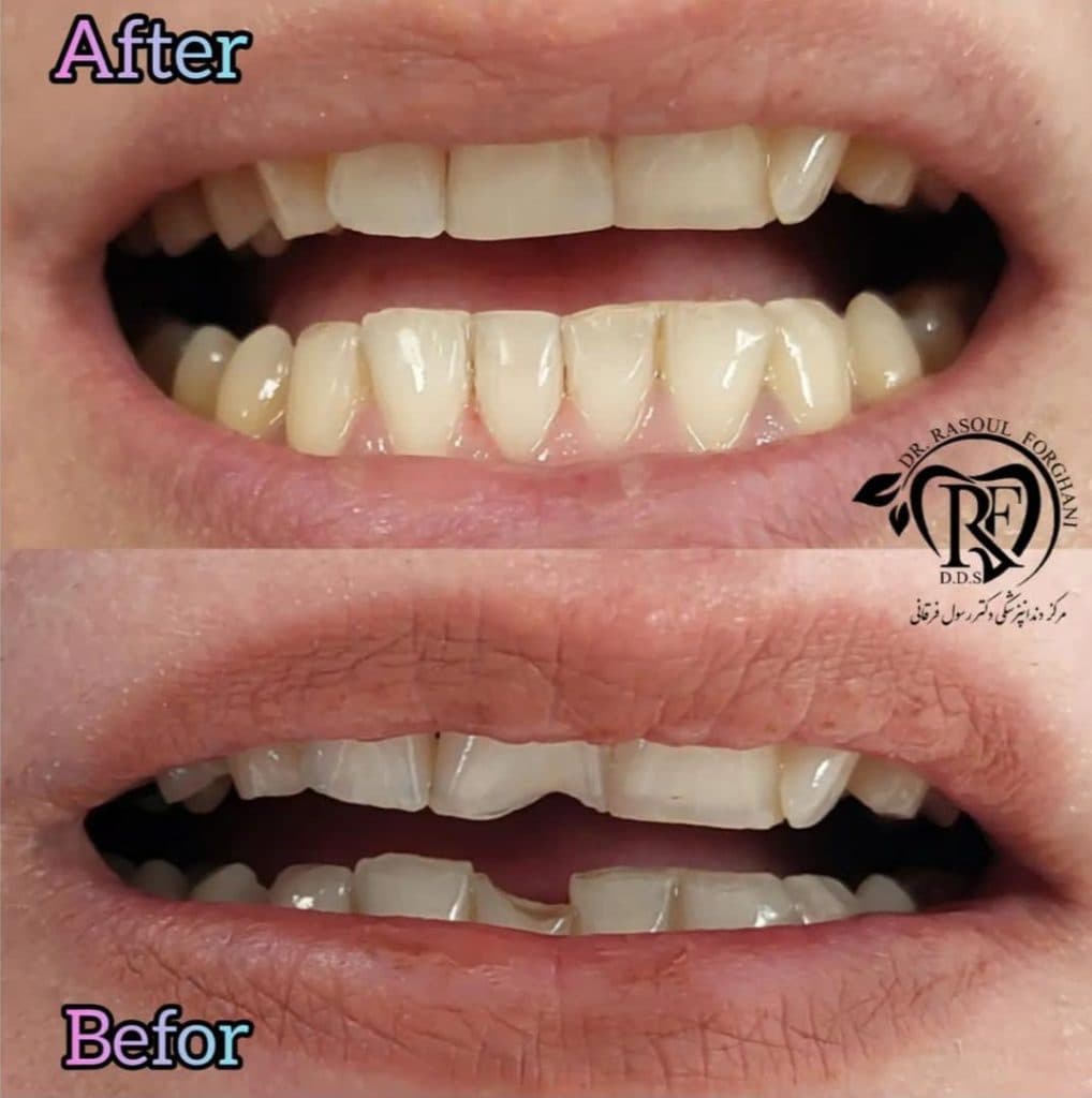 مرکز دندانپزشکی دکتر رسول فرقانی در بلوار طالقانی جنوبی کرج