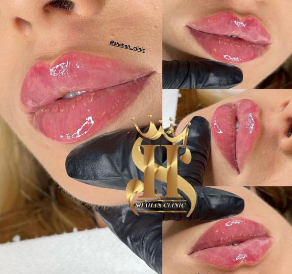 کلینیک زیبایی شاهان در اندرزگو تهران