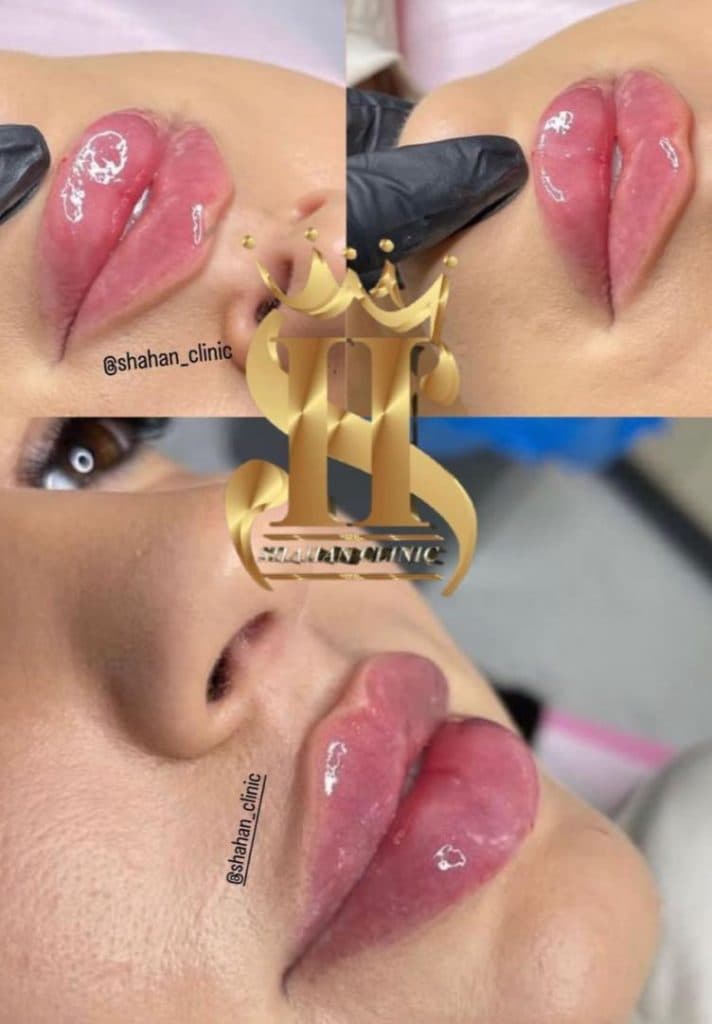 کلینیک زیبایی شاهان در اندرزگو تهران