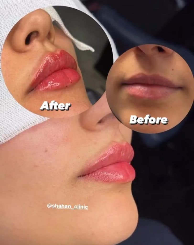 کلینیک زیبایی شاهان در اندرزگو تهران