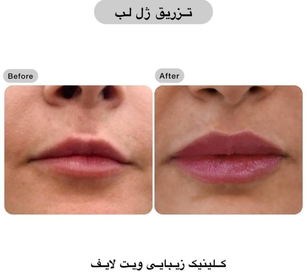 کلینیک زیبایی لیزر vip ویت لایف در امام خمینی بابلسر