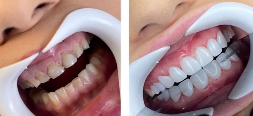 کلینیک دندانپزشکی دکتر موسوی در اتوبان شهید باقری تهران