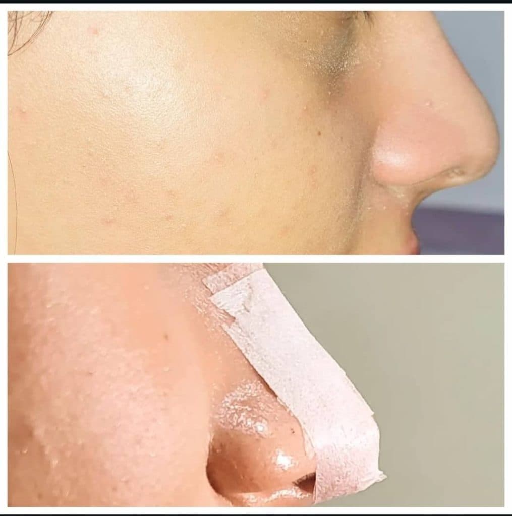 مطب زیبایی دکتر حاجی زاده در تبریز