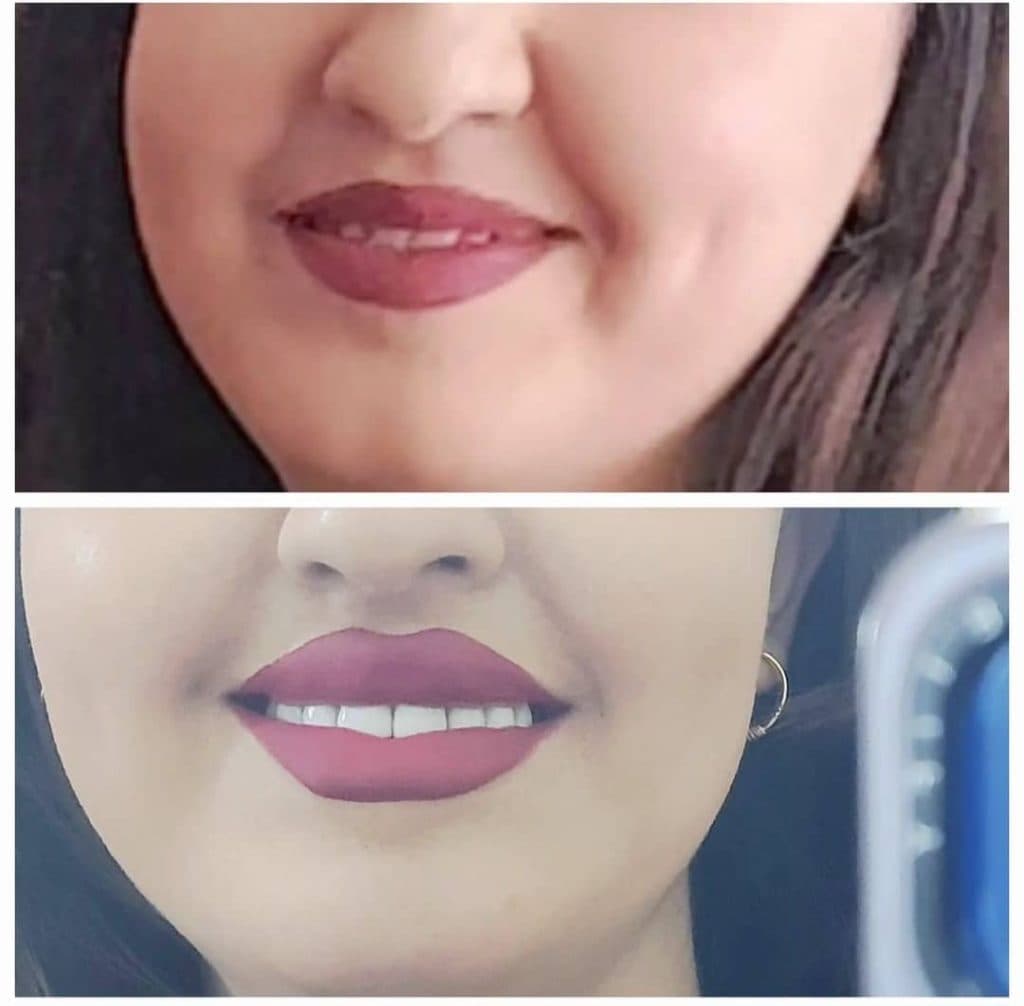 مطب زیبایی دکتر حاجی زاده در تبریز