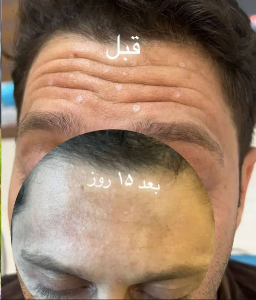 مطب زیبایی دکتر حاجی زاده در تبریز