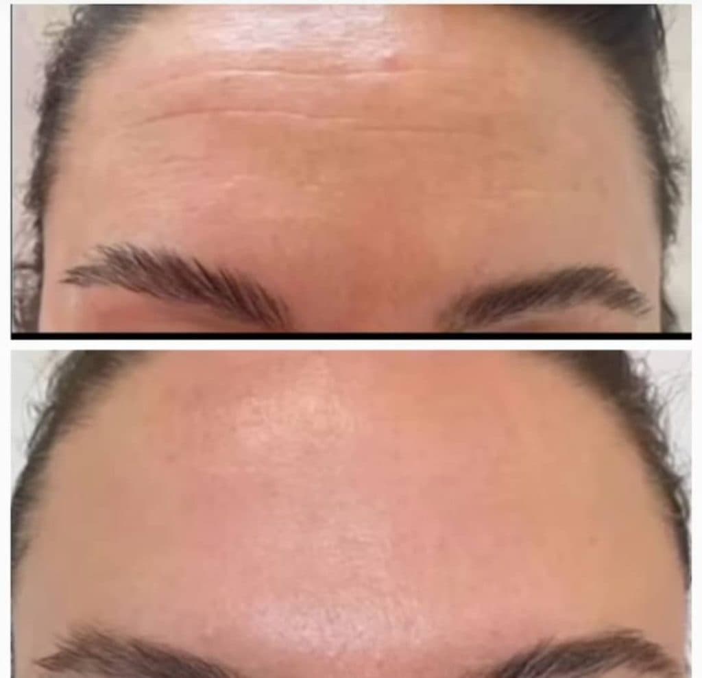 مطب زیبایی دکتر حاجی زاده در تبریز