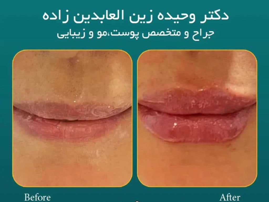 کلینیک تخصصی پوست و مو آذرنوین در هفده شهریور قدیم تبریز