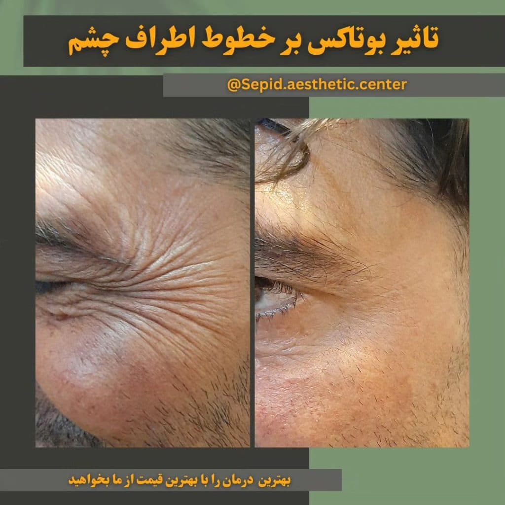 مرکز تخصصی زیبایی لیزر سپید در 17 شهریور تبریز