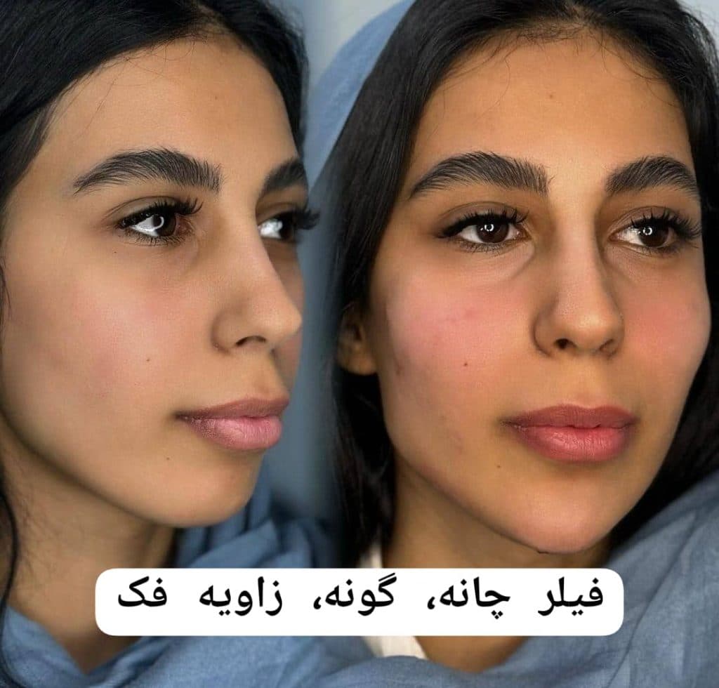 کلینیک زیبایی پوست و مو سارا در چالوس