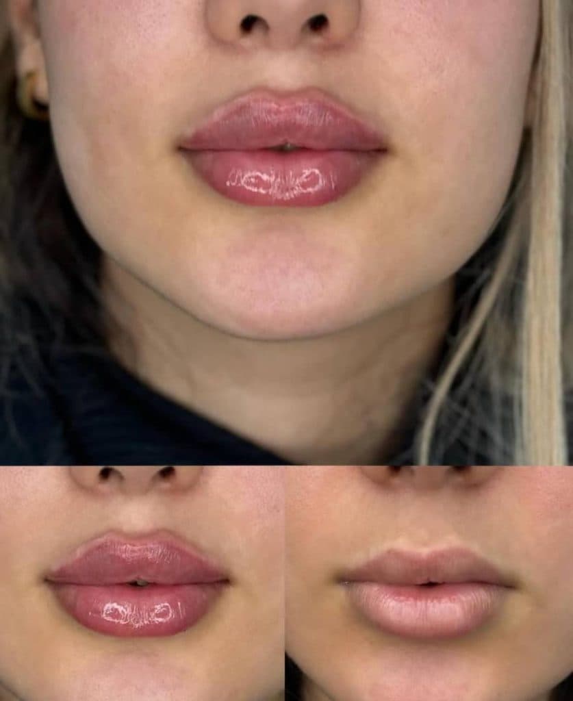 کلینیک زیبایی پوست و مو سارا در چالوس