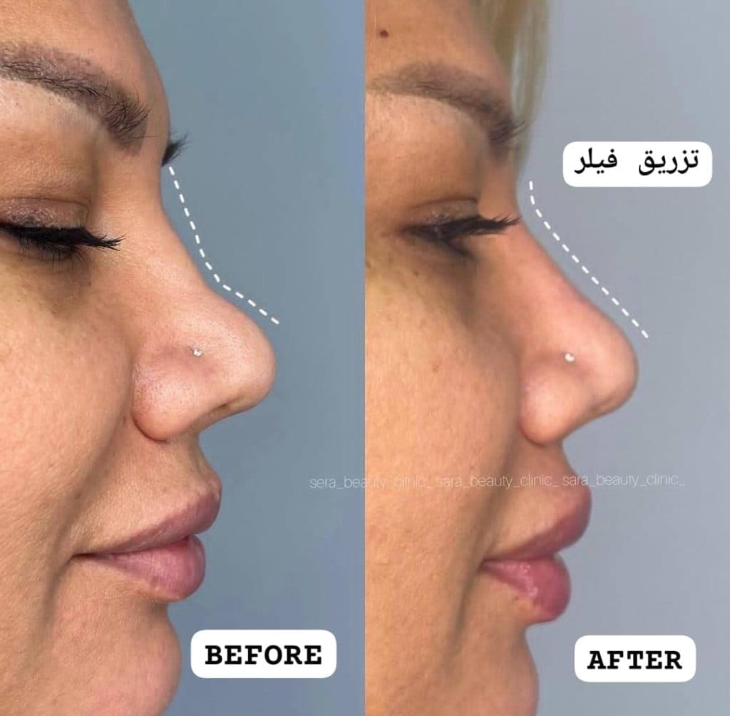 کلینیک زیبایی پوست و مو سارا در چالوس