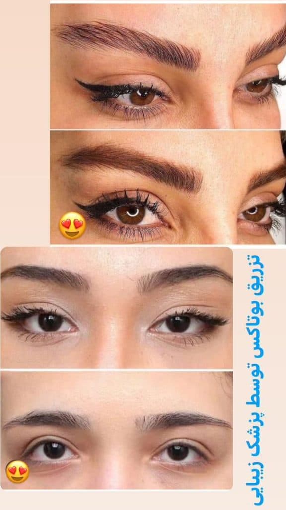 مرکز تخصصی لیزر آروشا در شهریار تهران