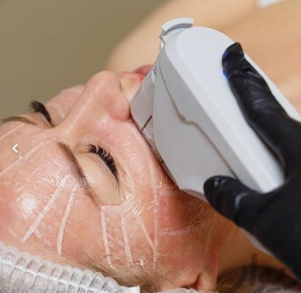 خدمات تخصصی پوست و مو منیره بیوتی در پونک جنوبی تهران