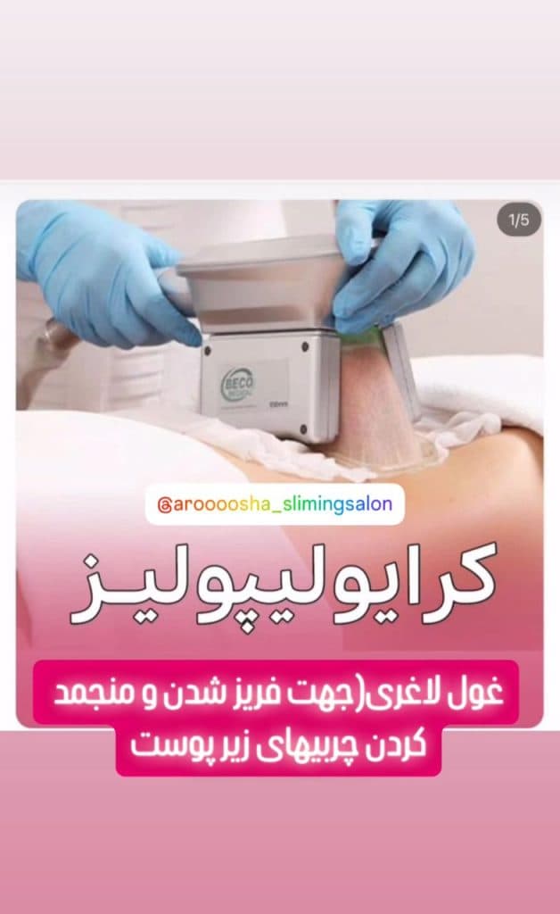 تزریق ژل و بوتاکس آروشا در شهریار