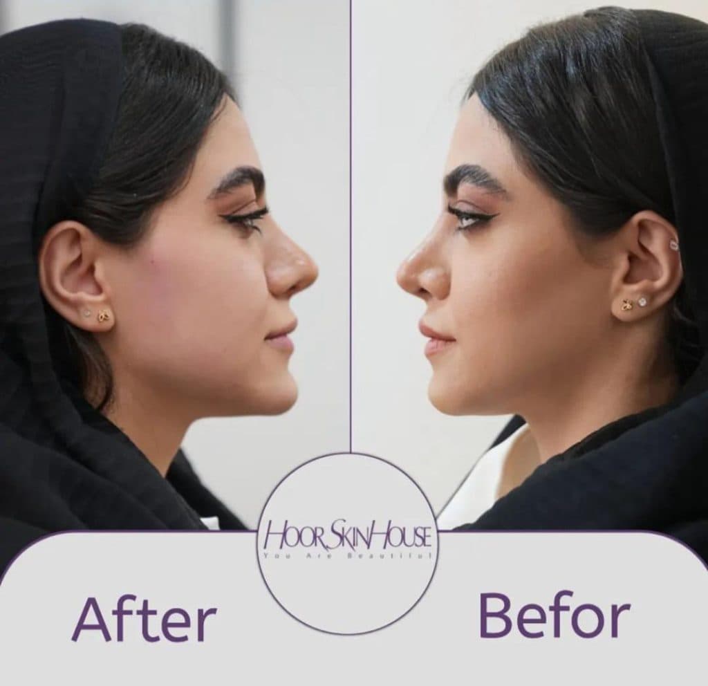 کلینیک زیبایی هور اسکین در بلوار سعادت آباد تهران