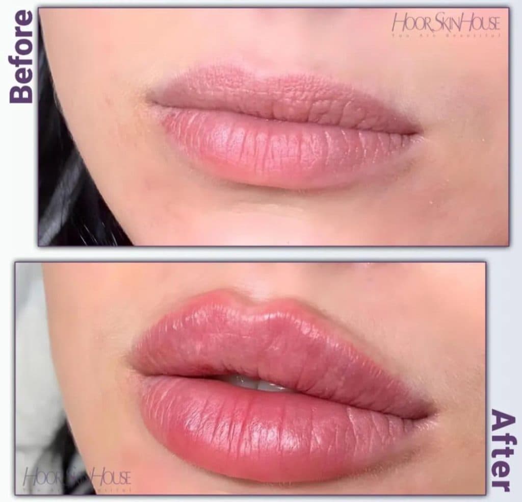 کلینیک زیبایی هور اسکین در بلوار سعادت آباد تهران