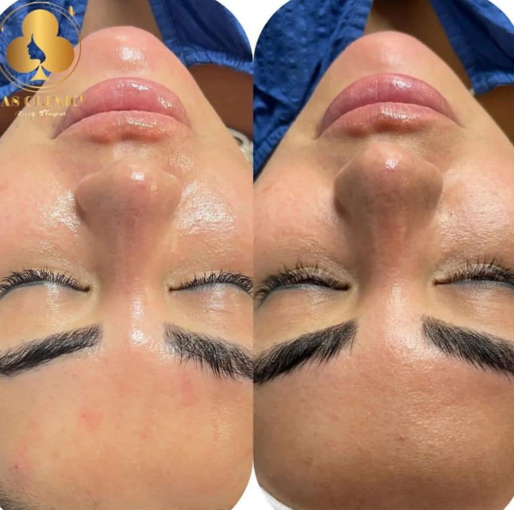 کلینیک زیبایی آس در چهارراه عمار یاسر ارومیه