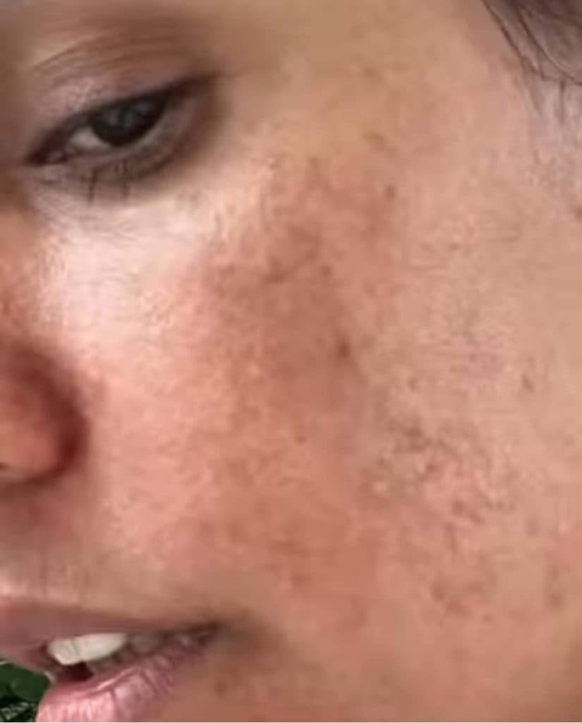 مرکز تخصصی ترمیم پوست و مو ماهک در صفائیه یزد