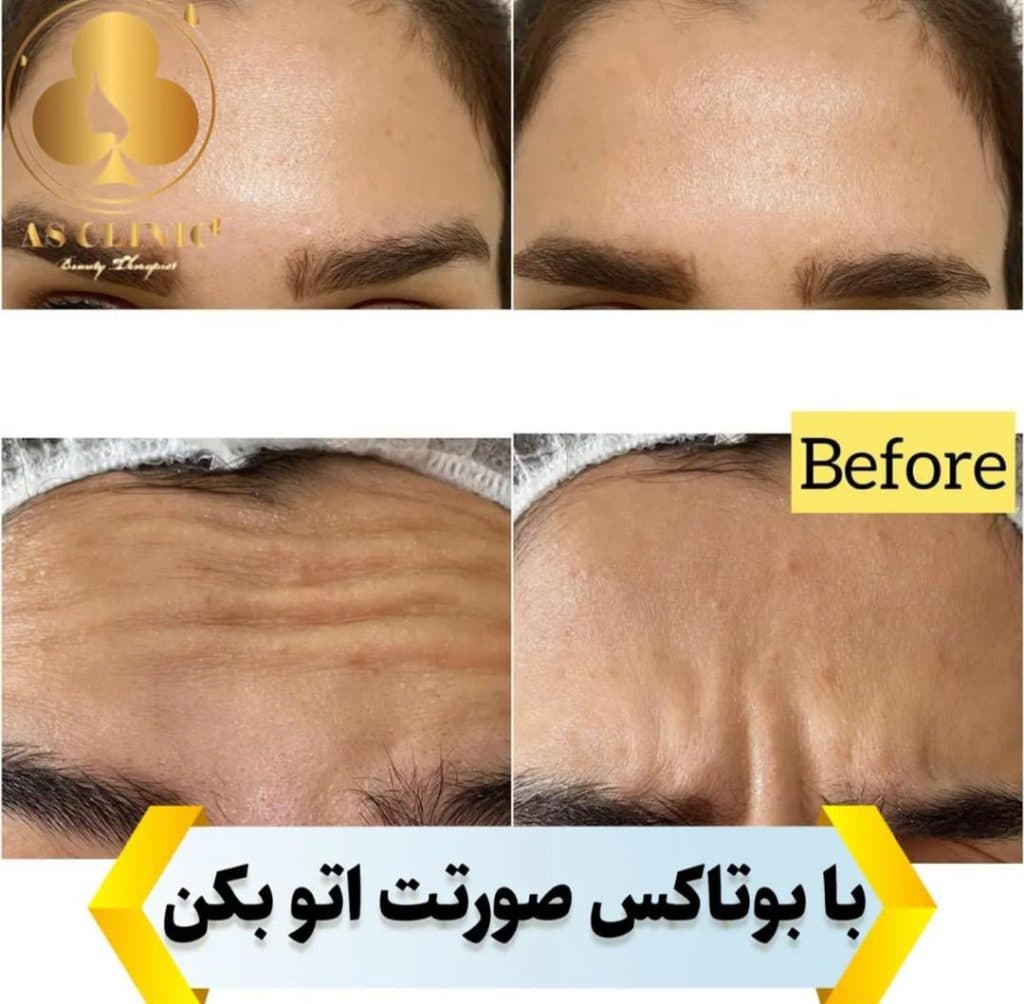 کلینیک زیبایی آس در چهارراه عمار یاسر ارومیه