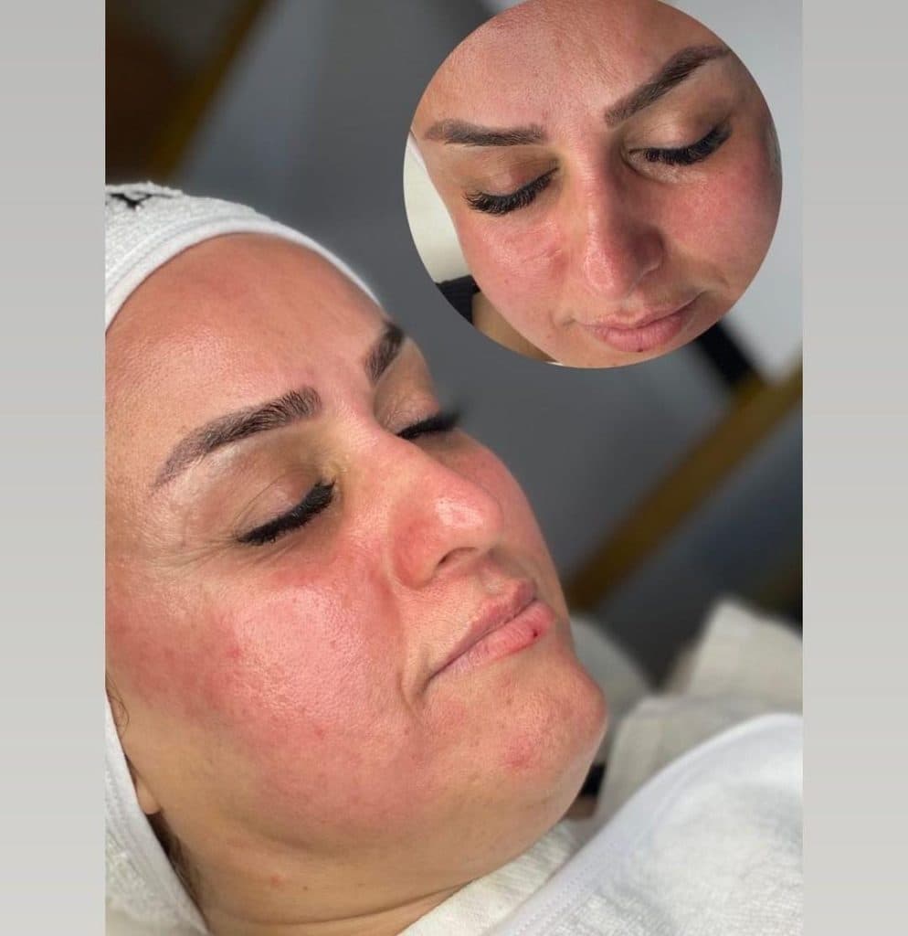 مرکز تخصصی زیبایی vip نیلوفر قربانی در لنگرود