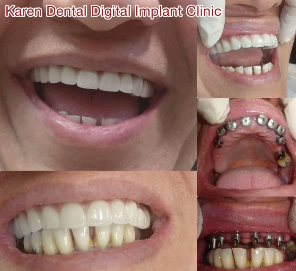 کلینیک دندانپزشکی و ایمپلنت دیجیتال کارن در کرمان